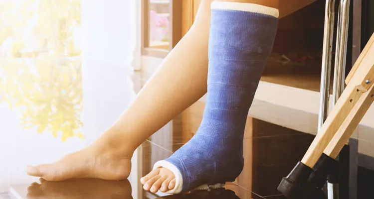 کاربرد گچ در پزشکی