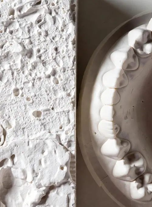 انواع گچ دندان پزشکی